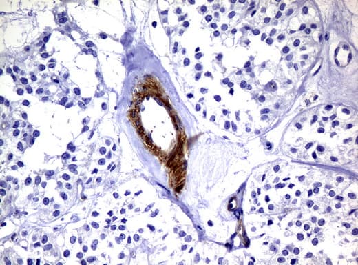 DEF6 Antibody (clone UMAB51)