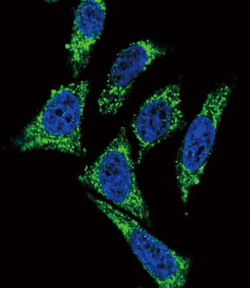 MDK / Midkine Antibody (aa113-143)