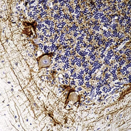 Neurofilament Antibody (clone 2F11)