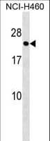 RAB41 Antibody (aa137-165)