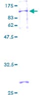 Human HSD-1 / SPAG8 Protein (Recombinant GST)