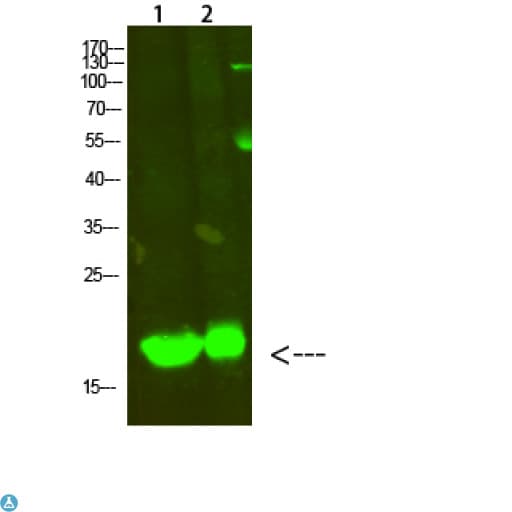 Polyclonal Rabbit anti-Human MYL2 Antibody (WB)