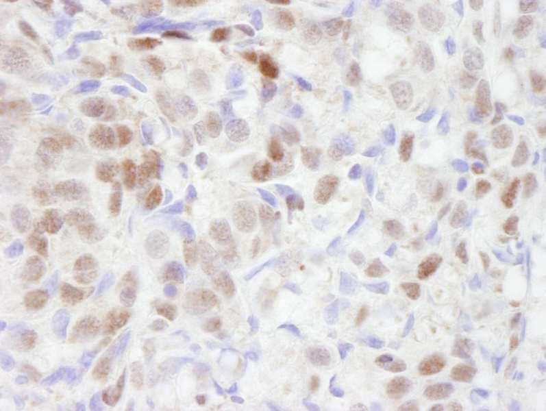 TBL1XR1 / TBLR1 Antibody (aa100-150)