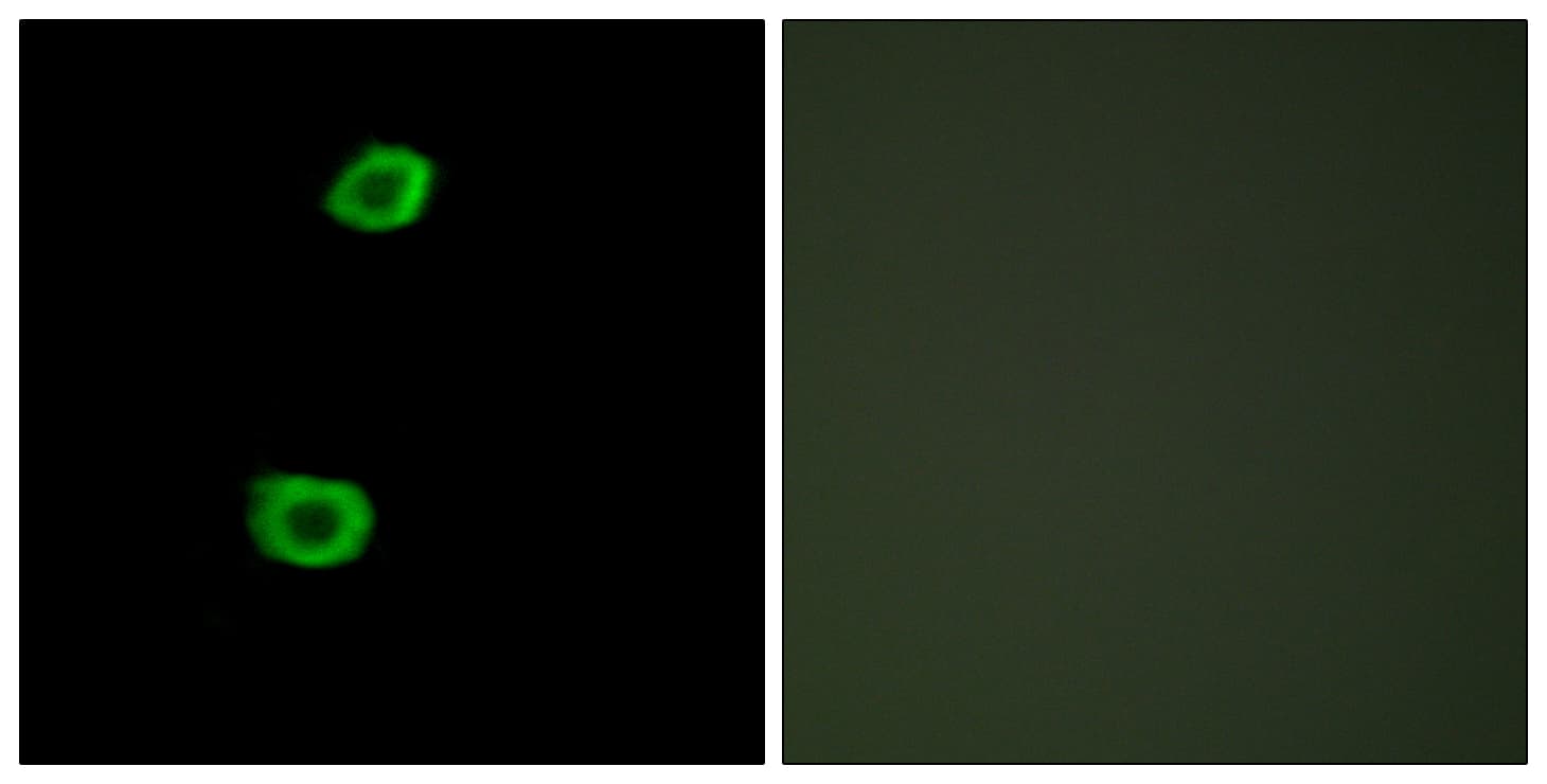 IHC-plus™ KPI-2 / LMTK2 Antibody (aa651-700)