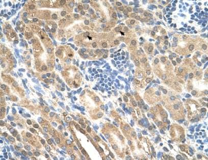 Polyclonal Rabbit anti-Human IHH Antibody (aa24-73, IHC, WB)