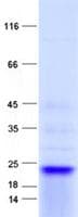 Human C5orf47 Protein (Recombinant His, N-Terminal)
