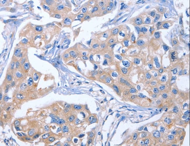 IHC-plus™ Polyclonal Rabbit anti-Human IBSP / Bone Sialoprotein Antibody (IHC)