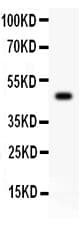 Polyclonal Rabbit anti-Human CD45 / LCA Antibody (aa1113-1304, IHC, WB)