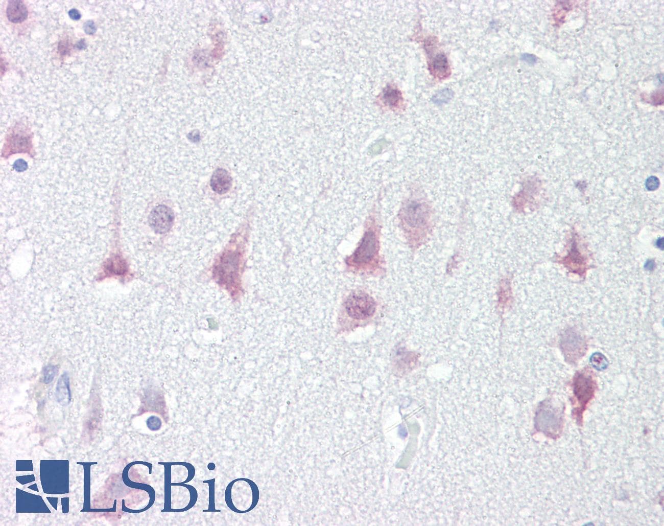 IHC-plus™ SIK1 / MSK Antibody
