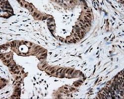 Monoclonal Mouse anti-Human TLDC1 / KIAA1609 Antibody (clone OTI5D9, IHC, IF, WB)