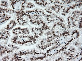 NOTCH1 Antibody (clone OTI3E12)