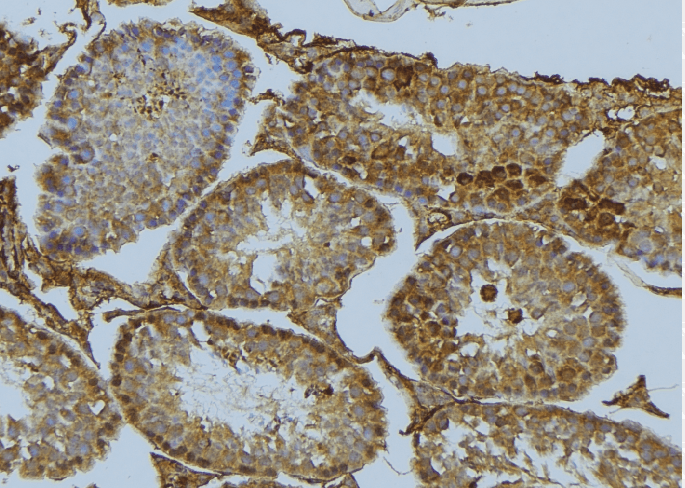 SEPT6 / Septin 6 Antibody