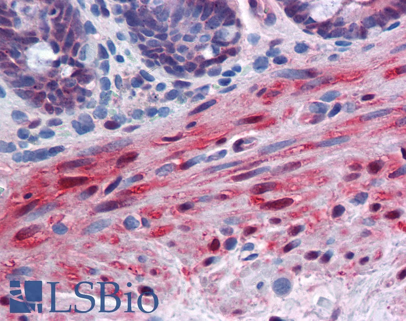 IHC-plus™ Monoclonal Mouse anti-Human YAP / YAP1 Antibody (clone 2F12, IHC, IF, WB)