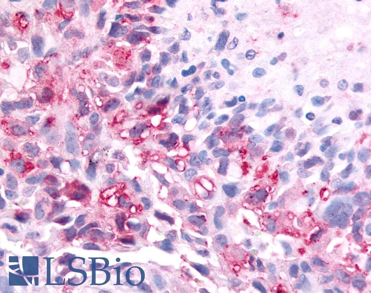 PathPlus™ Polyclonal Rabbit anti-Human PAK6 Antibody (Linker Domain, IHC)