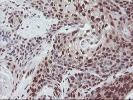 EXOSC7 Antibody (clone OTI1G8)