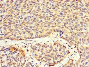 VTA1 Antibody