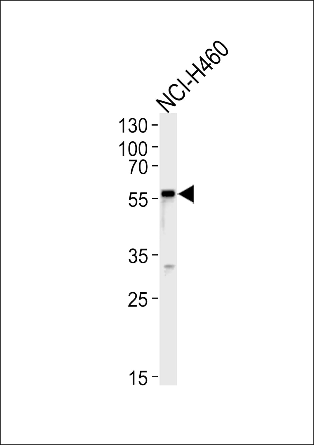 GABRA2 Antibody (aa378-406)