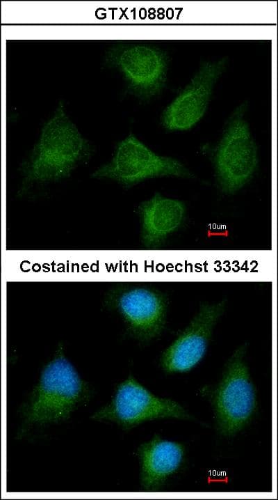 CACNB1 Antibody