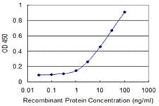 HAVCR1 / KIM-1 Antibody (clone 2G11)