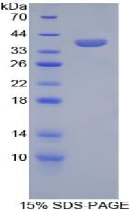 Human SPINK1 Protein (Recombinant His-GST)