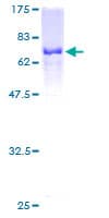 Human PAICS / ADE2 Protein (Recombinant GST)