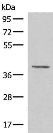 MECR Antibody