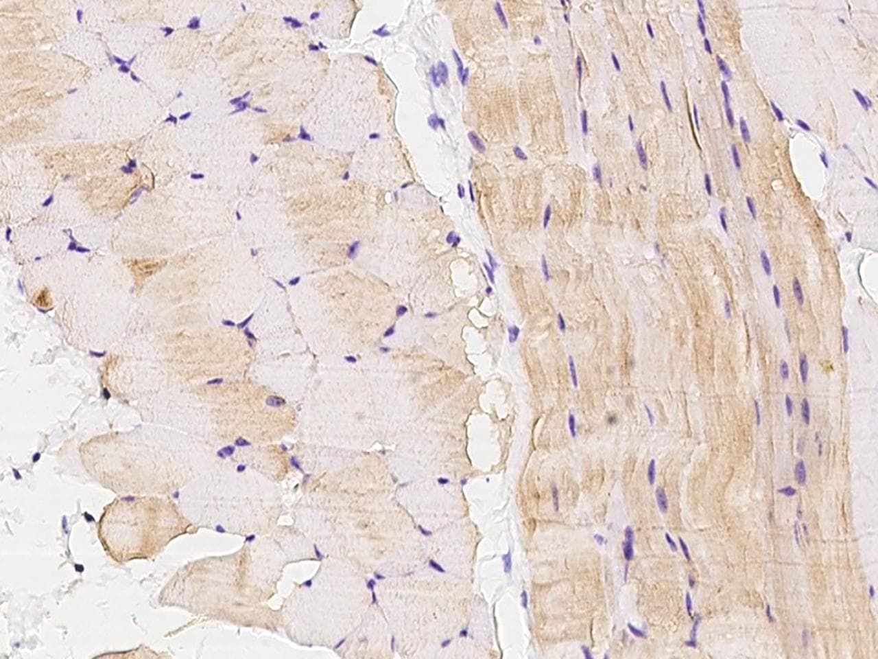 ANGPTL4 Antibody (Preservative Free)