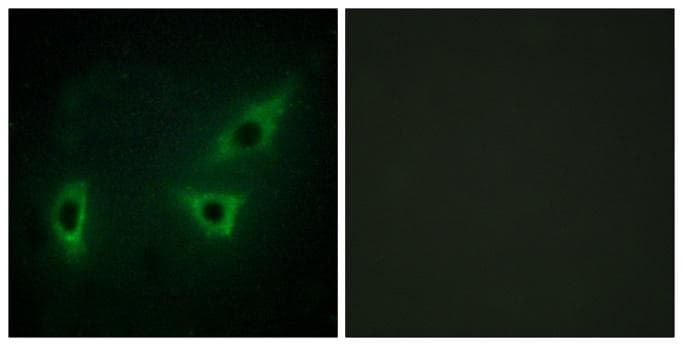 Polyclonal Rabbit anti-Human WC1 / ATP7B Antibody (IHC, IF)