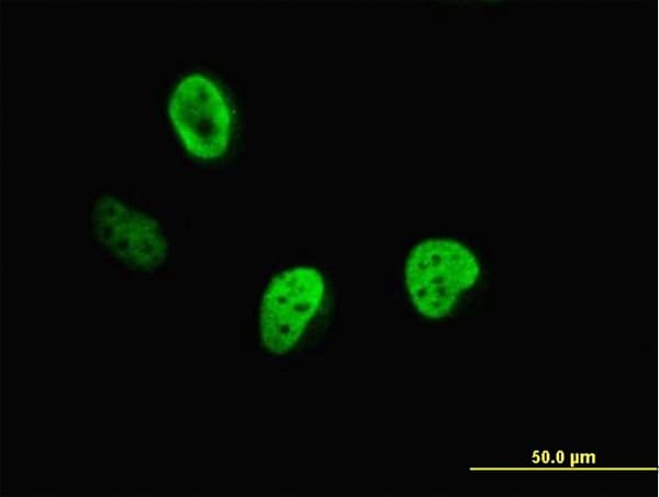 IHC-plus™ CUX1 / CASP Antibody (clone 2A10)