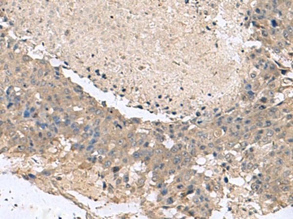 Polyclonal Rabbit anti-Human KCTD7 Antibody (IHC, WB)