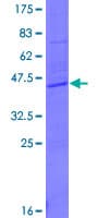 Human WRB Protein (Recombinant GST)