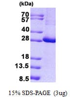 Human KCTD11 Protein (Recombinant His)