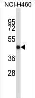 Polyclonal Rabbit anti-Human OPG / Osteoprotegerin Antibody (aa243-271, IHC, IF, WB)