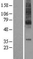 MCHR1 Protein (Over-Expression Lysate Myc-DDK (Flag))
