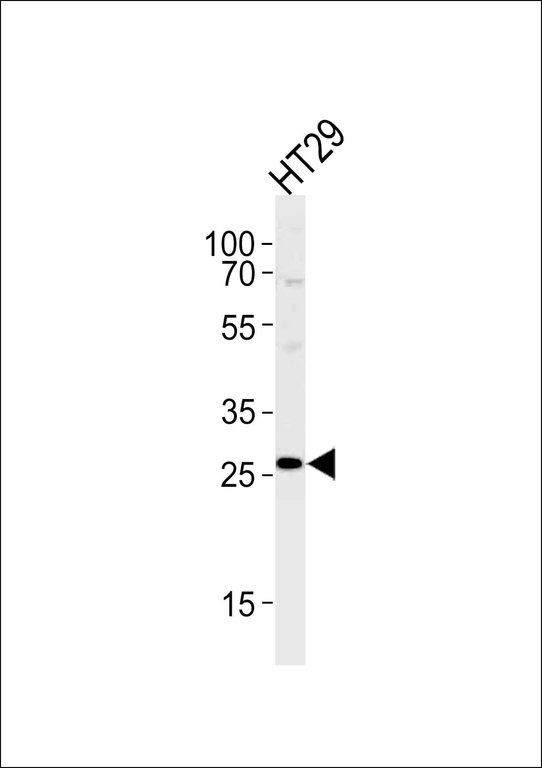 Polyclonal Rabbit anti-Human NNMT Antibody (aa101-130, IHC, WB)