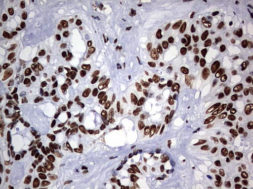 HNRPM / HNRNPM Antibody (aa1-261, clone OTI6H7)