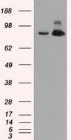 Monoclonal Mouse anti-Human ACO2 / Aconitase 2 Antibody (clone OTI7A11, IF, WB)
