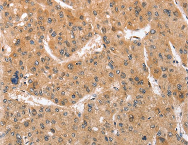 APG12 / ATG12 Antibody