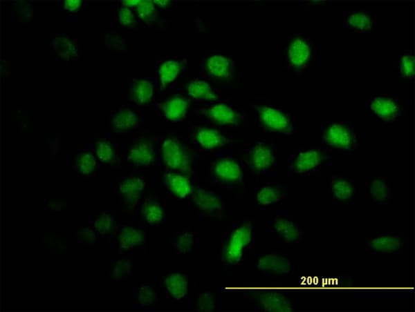 Monoclonal Mouse anti-Human CARF / ALS2CR8 Antibody (clone 2A3, IHC, IF, WB)