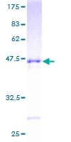 Human RAC3 Protein (Recombinant GST)