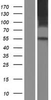 SLC41A1 Protein (Over-Expression Lysate Myc-DDK (Flag))