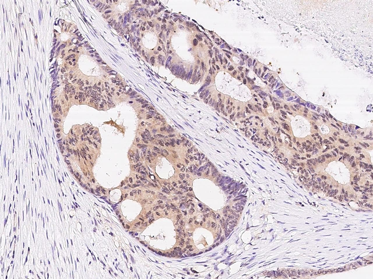 CHUK / IKKA / IKK Alpha Antibody (Preservative Free)