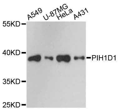 PIH1D1 Antibody