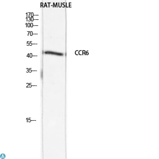 CCR6 Antibody