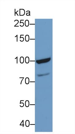 TOP1 / Topoisomerase I Antibody (aa1-250)