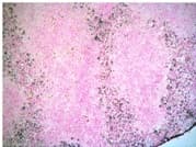 LY6C + LY6G Antibody (clone NIMP-R14)