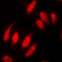 IHC-plus™ TOP2A / Topoisomerase II Alpha Antibody (N-Terminus)