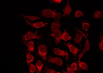 STEAP4 Antibody