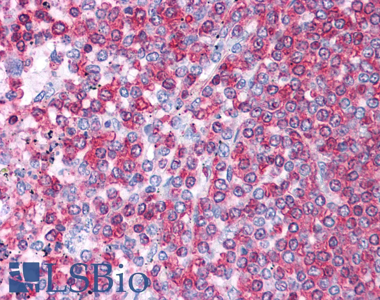 HSPA8 / HSC70 Antibody (aa143-192)