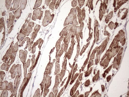 KRT16 / CK16 / Cytokeratin 16 Antibody (clone OTI6A11)